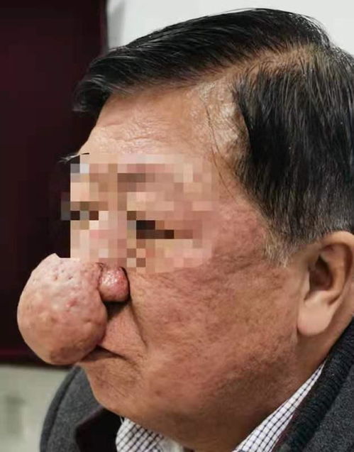 吴亦凡不会放过都美竹